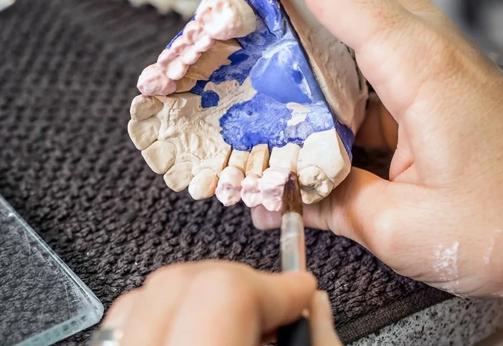 Top 5 Signs Your Dentures Need Repairing